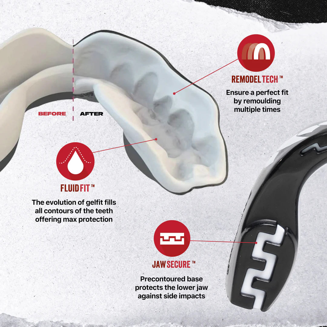 SafeJawz Extro Series Mouthguard
