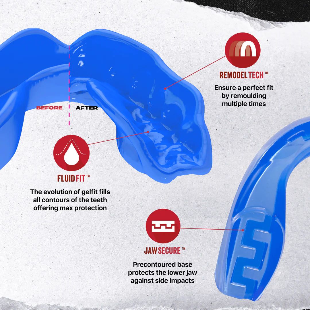 SafeJawz Extro Series ICE Mouthguard