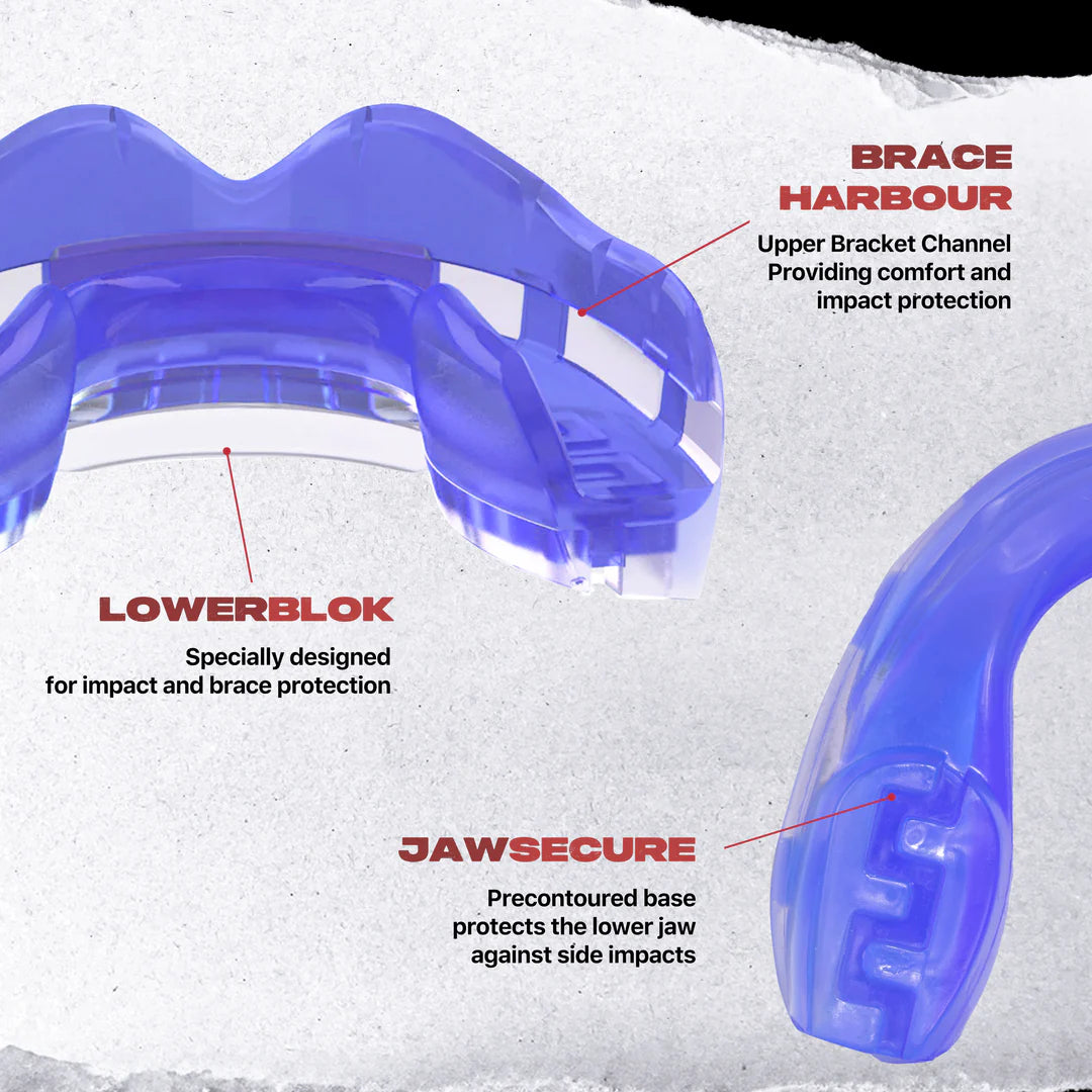 SafeJawz Ortho Series Mouthguard - Thumbnail 2