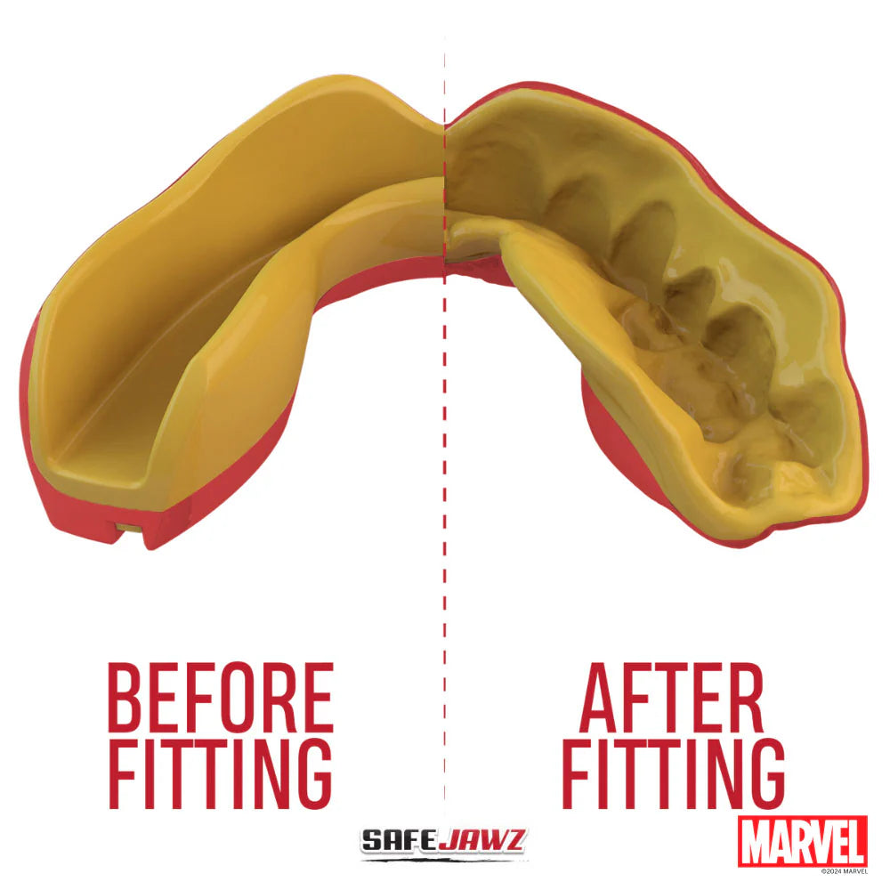 SafeJawz Marvel Iron-Man Mouthguard
