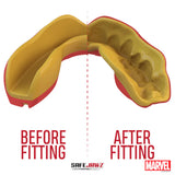 SafeJawz Marvel Iron-Man Mouthguard